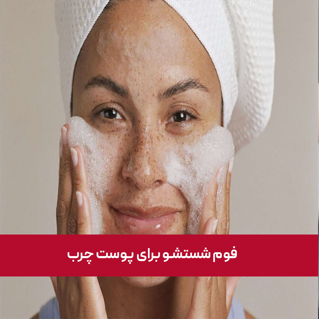 معرفی "فوم شستشو برای پوست چرب" در سال 1404